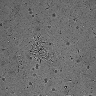 Dejection Punaise De Lit Impressionnant Pdf Bed Bugs Cimex Lectularius as Vectors Of Trypanosoma Cruzi